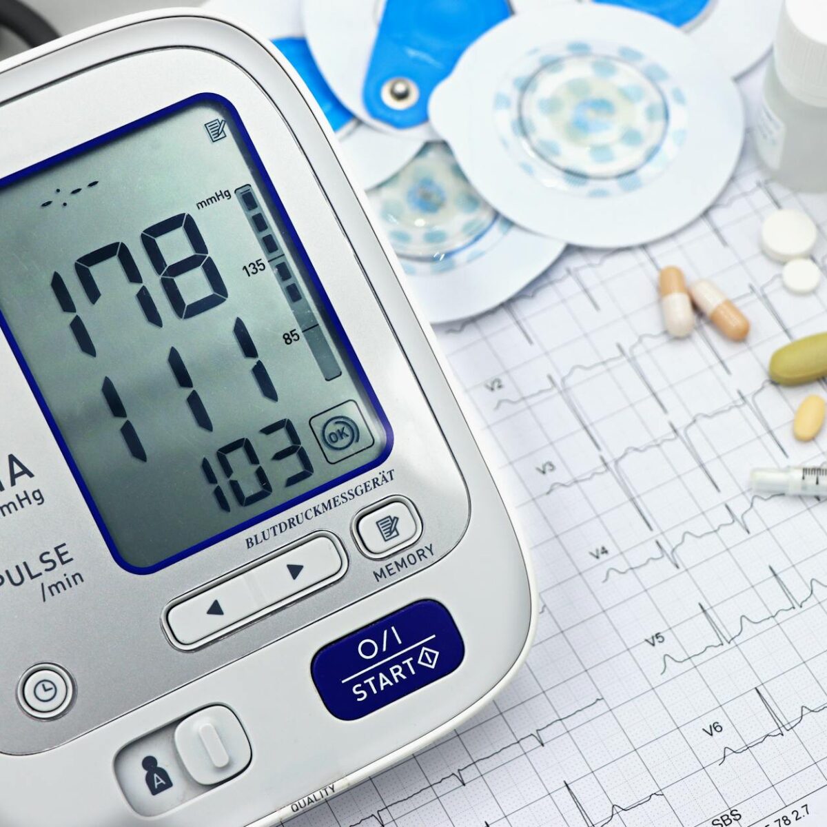Para entender os números do seu exame de colesterol HDL e LDL, o HDL é o "colesterol bom" que protege as artérias, enquanto o